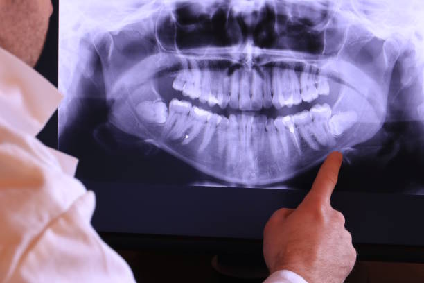 Best Emergency Dentist for Special Needs Patients in Black Point Green Point, CA